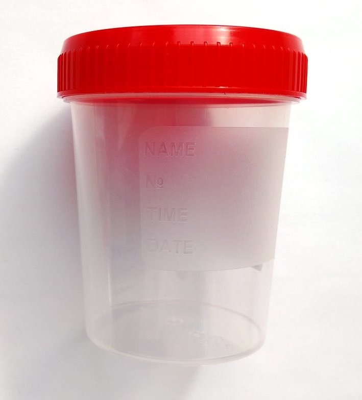 Container nesteril, pentru urină, gradat, cu capac, 120 ml  USC